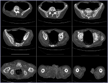 CTscan-2169e7b102d745b2f8010cfbda2bb1bd6b69f0b5b9c2669e7af9d5bbb027866e